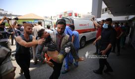 اصابة اطفال معركة سيف القدس (1).JPG